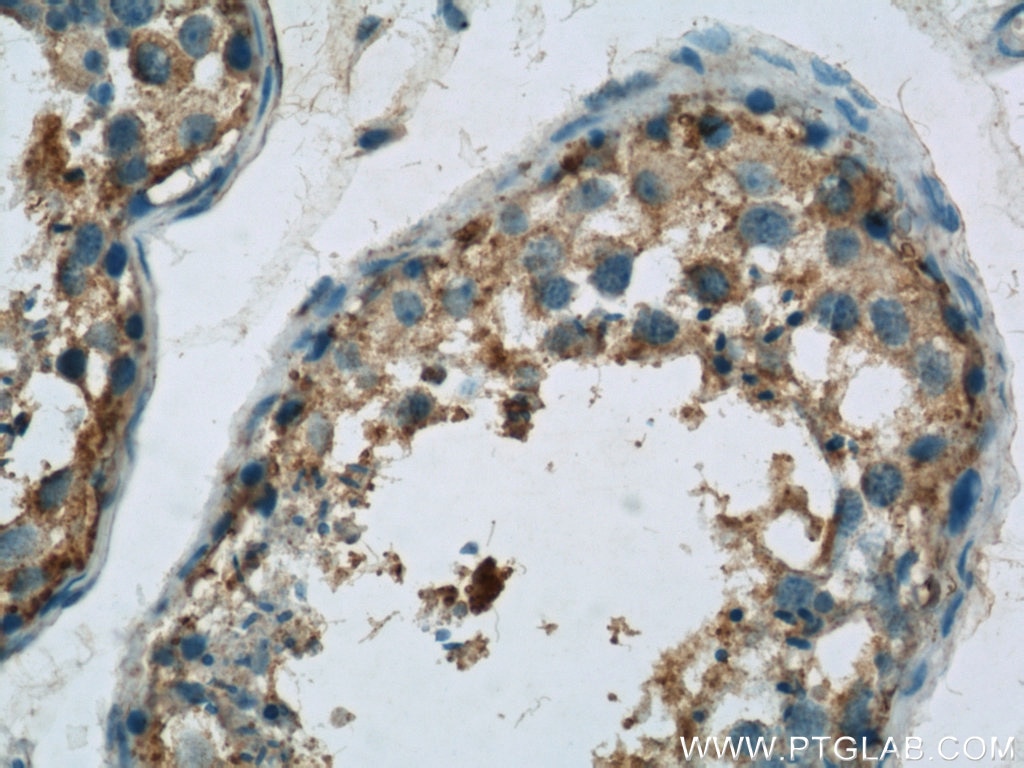 IHC staining of human testis using 23418-1-AP