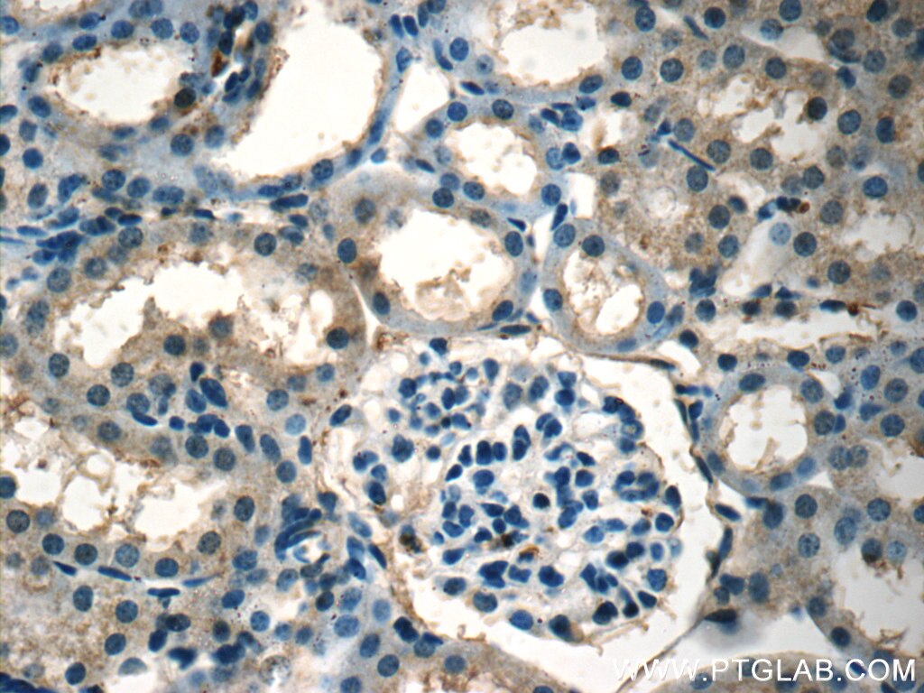 IHC staining of mouse kidney using 23418-1-AP