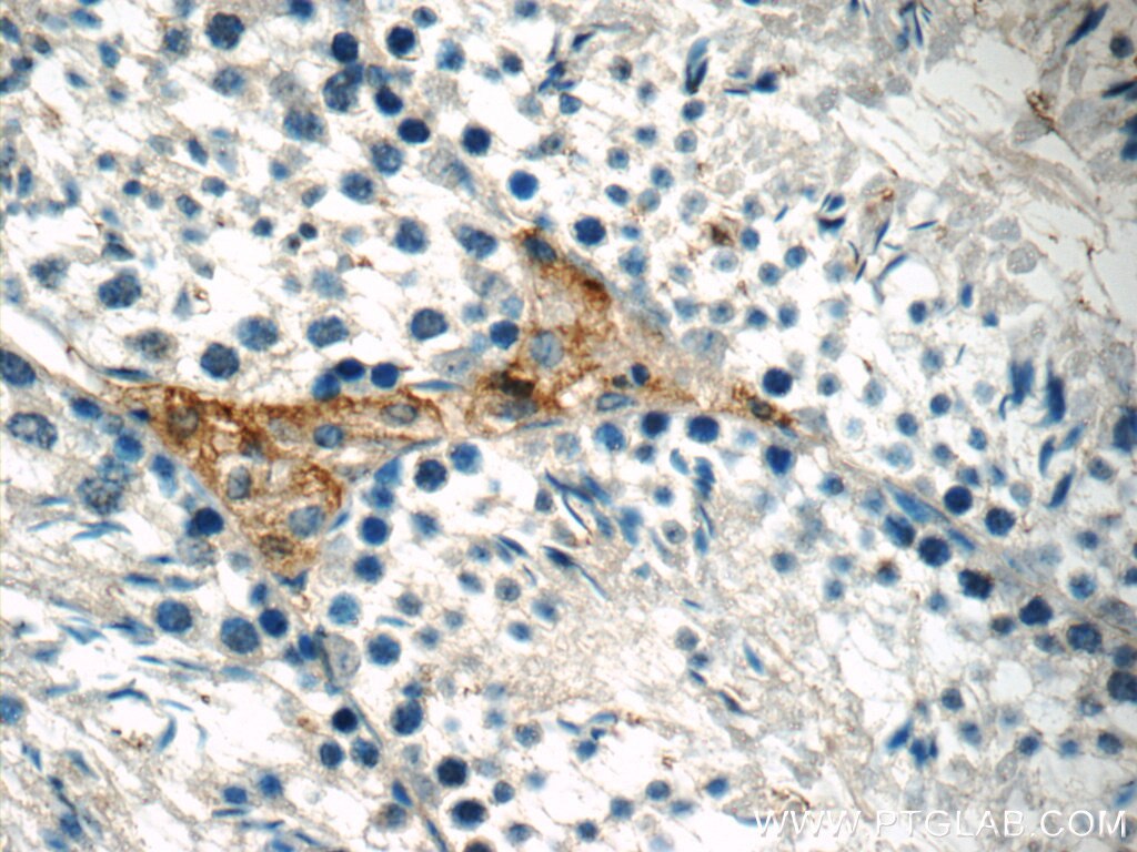 IHC staining of mouse testis using 23418-1-AP