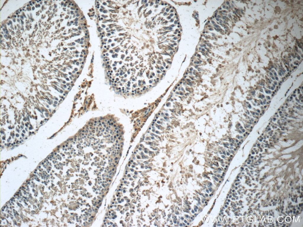 Immunohistochemistry (IHC) staining of rat testis tissue using Osteocalcin Polyclonal antibody (23418-1-AP)