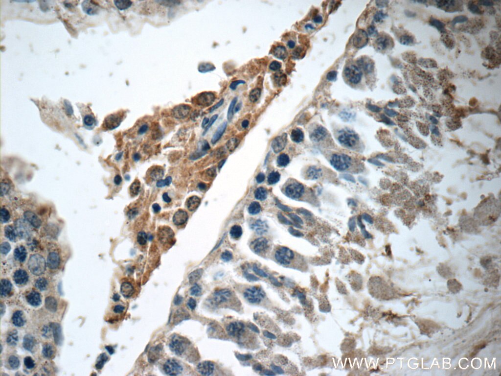 Immunohistochemistry (IHC) staining of rat testis tissue using Osteocalcin Polyclonal antibody (23418-1-AP)
