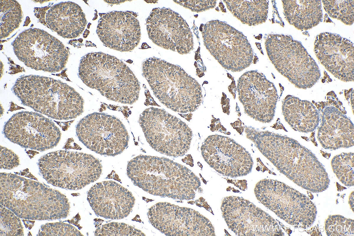 IHC staining of mouse testis using 23418-1-AP