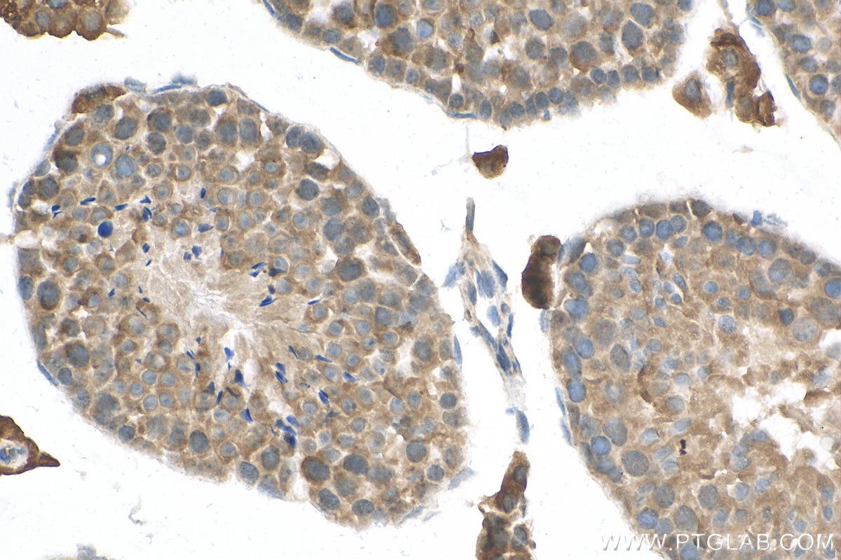 Immunohistochemistry (IHC) staining of mouse testis tissue using Osteocalcin Polyclonal antibody (23418-1-AP)