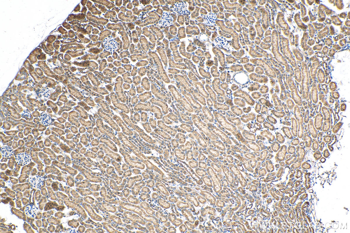 Immunohistochemistry (IHC) staining of mouse kidney tissue using Osteocalcin Polyclonal antibody (23418-1-AP)