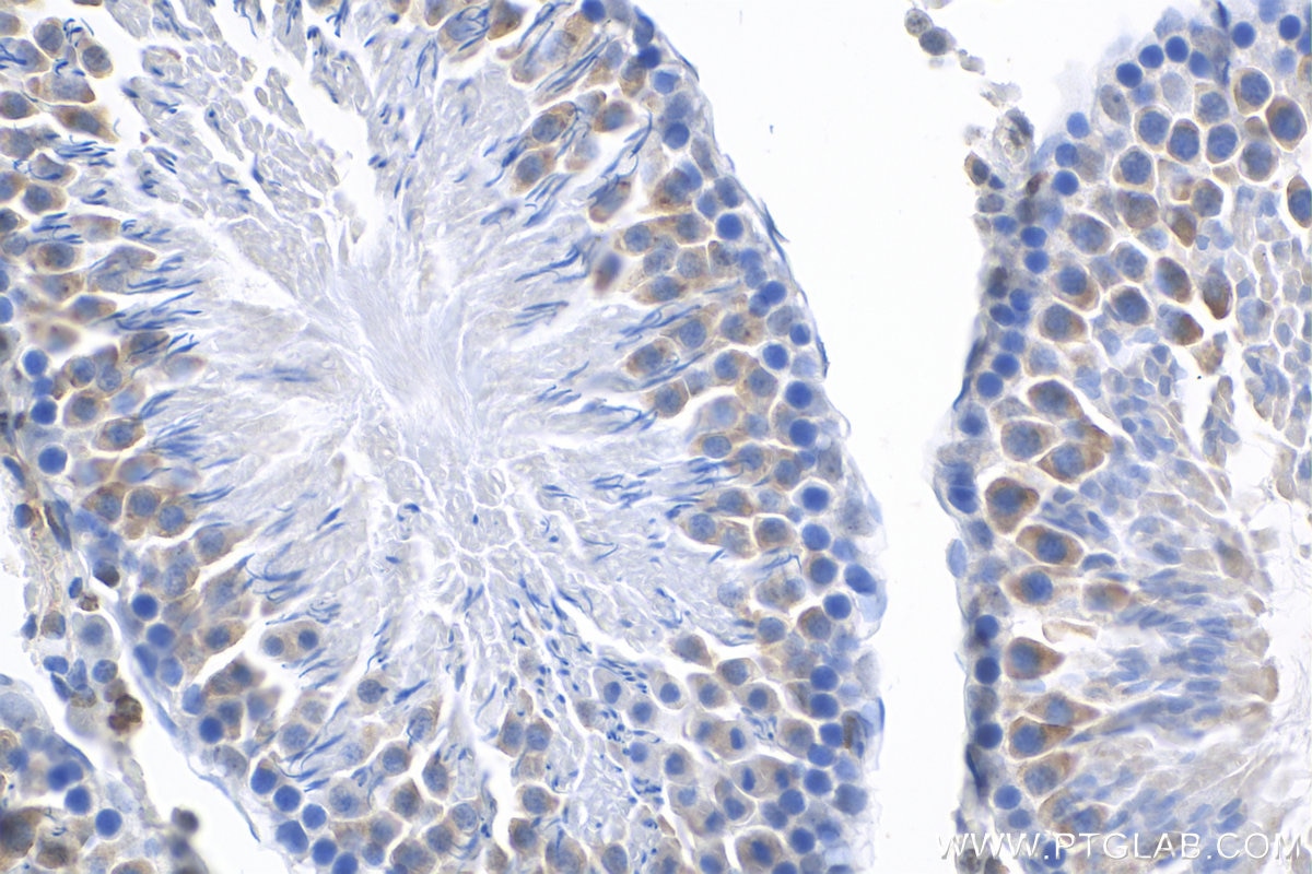 IHC staining of rat testis using 23418-1-AP