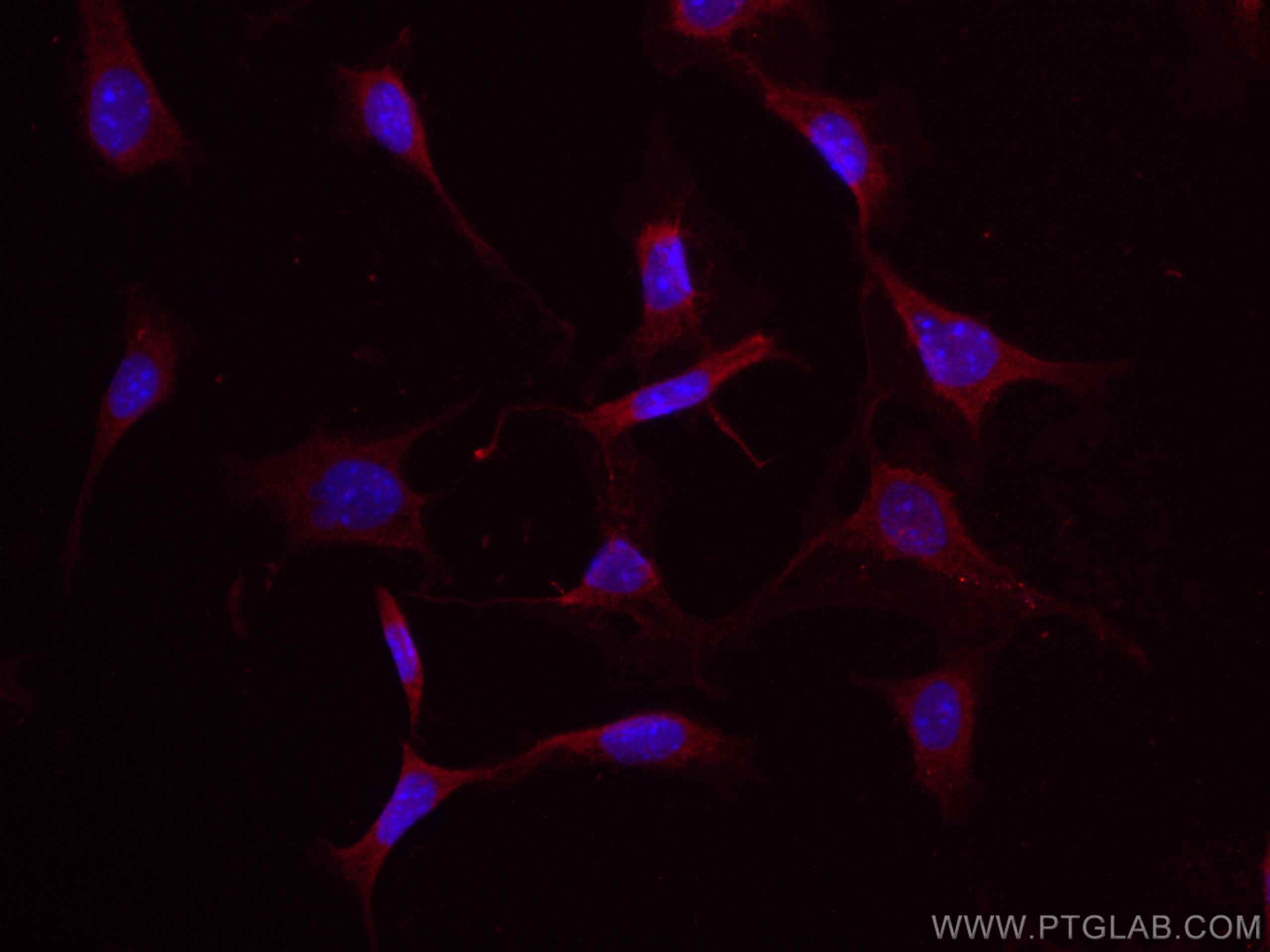 Osteocalcin/OCN