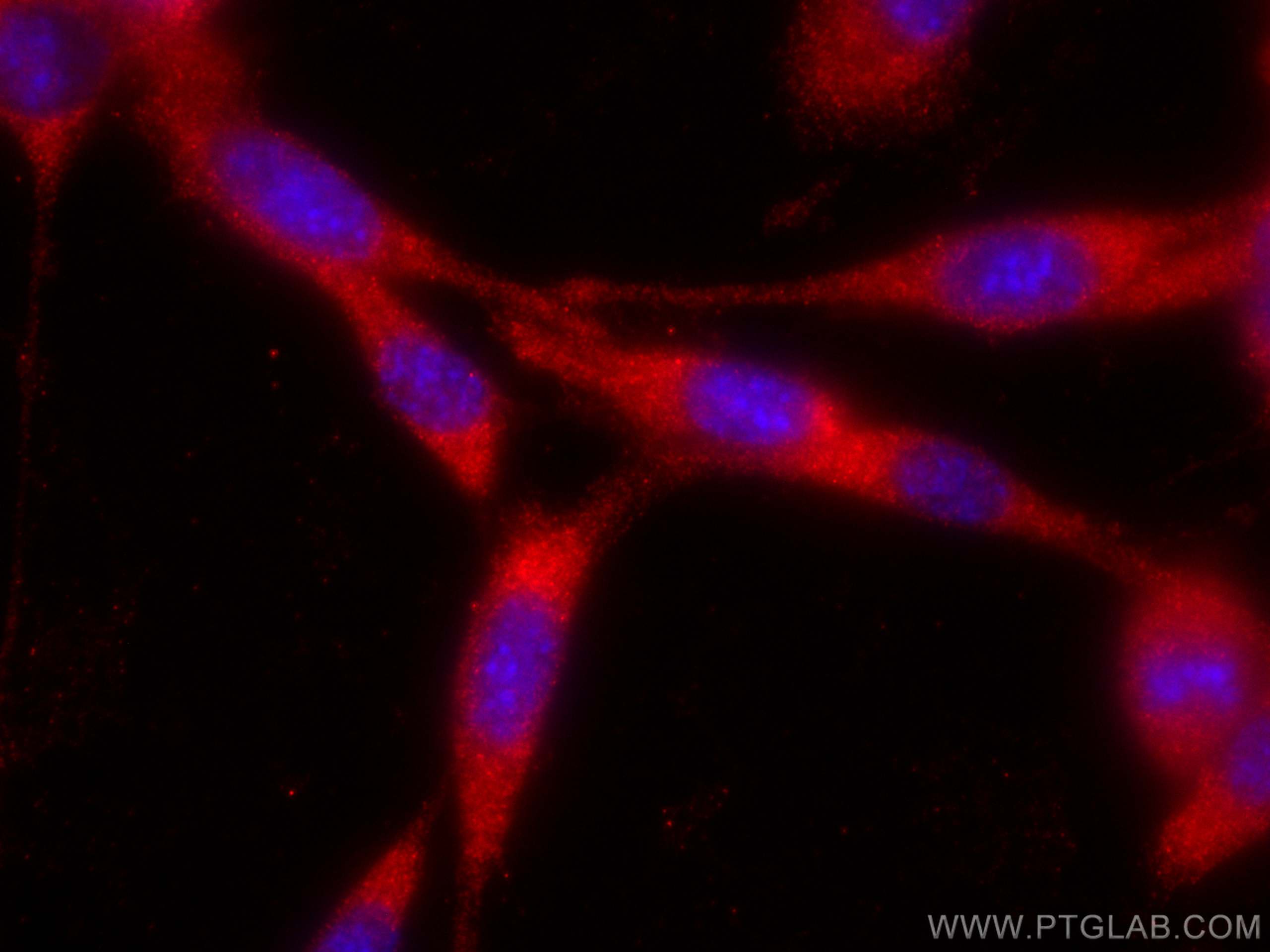 Immunofluorescence (IF) / fluorescent staining of NIH/3T3 cells using CoraLite®594-conjugated Osteocalcin Polyclonal ant (CL594-23418)