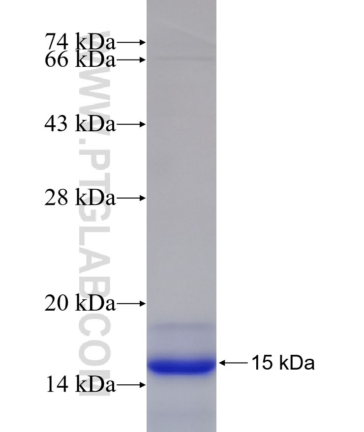 Osteocalcin fusion protein Ag20118 SDS-PAGE Osteocalcin fusion protein Ag20118 SDS-PAGE