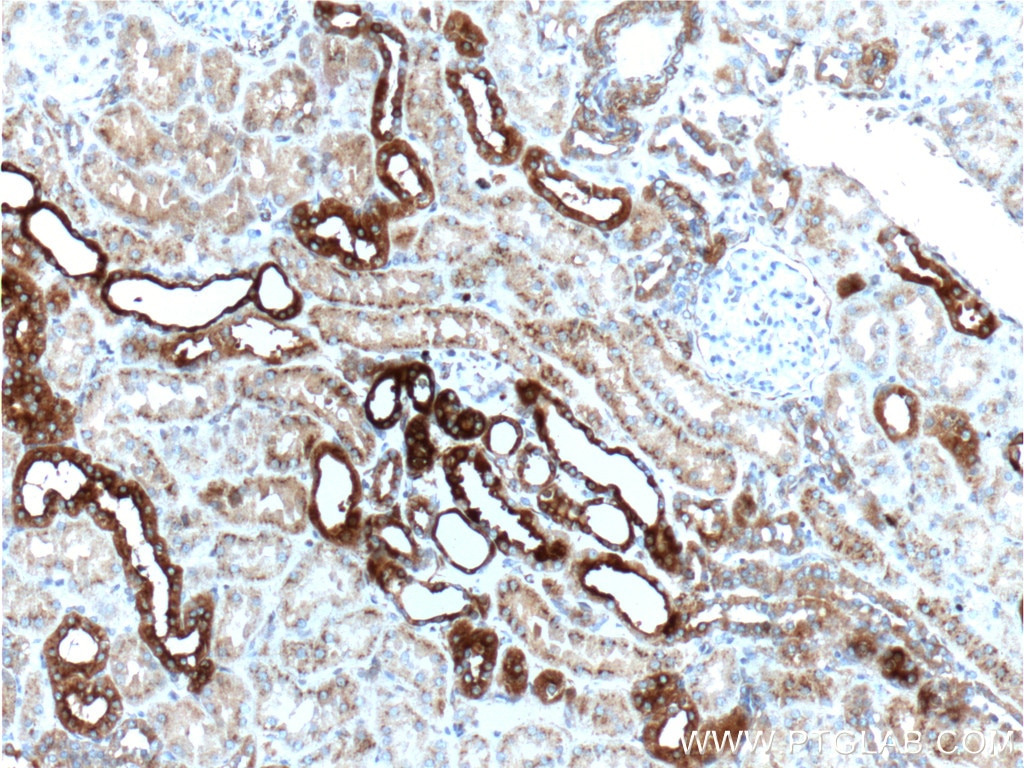 Immunohistochemistry (IHC) staining of human kidney tissue using Osteopontin Polyclonal antibody (25715-1-AP)