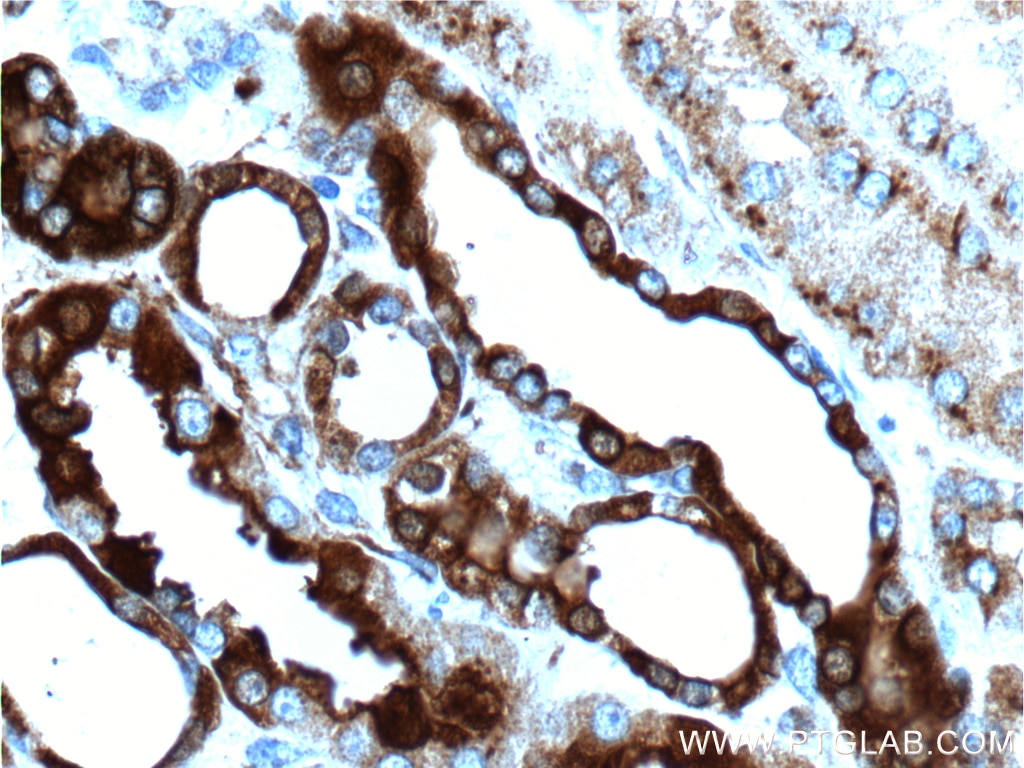 Immunohistochemistry (IHC) staining of human kidney tissue using Osteopontin Polyclonal antibody (25715-1-AP)