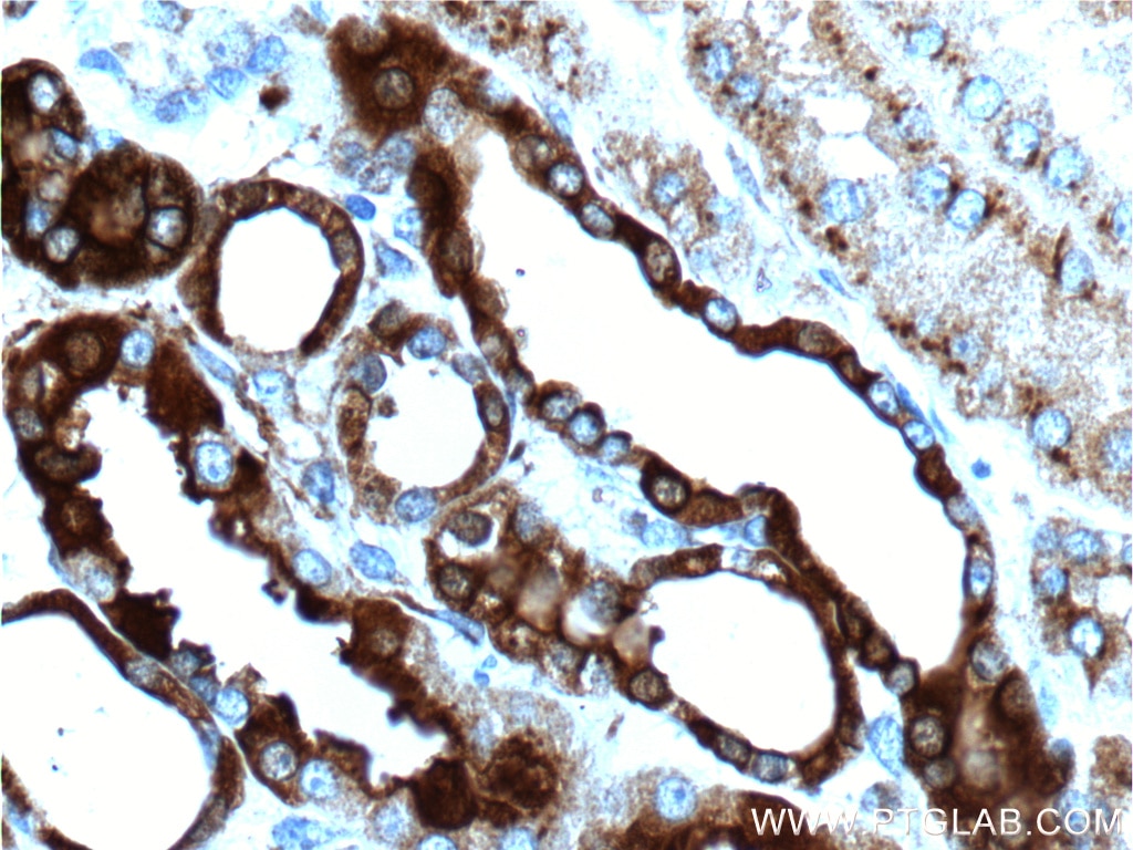 IHC staining of human kidney using 25715-1-AP