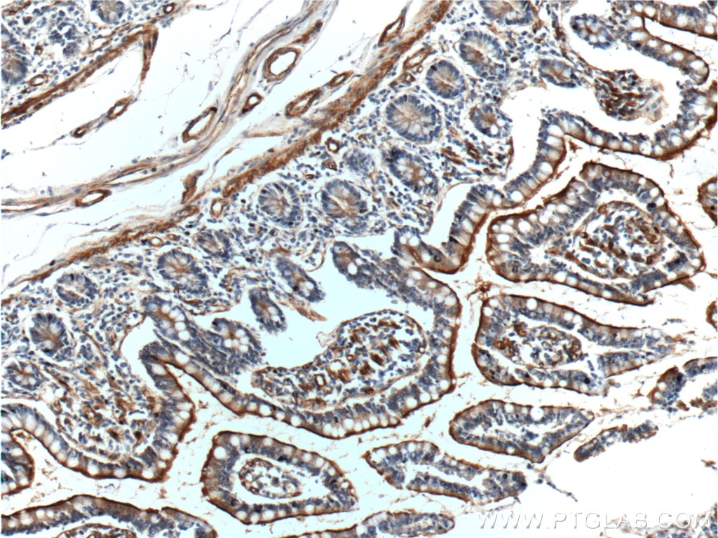 IHC staining of human small intestine using 25715-1-AP