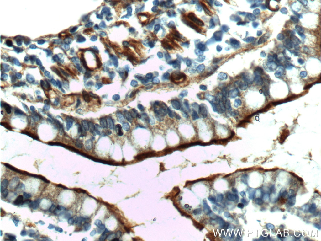 Immunohistochemistry (IHC) staining of human small intestine tissue using Osteopontin Polyclonal antibody (25715-1-AP)