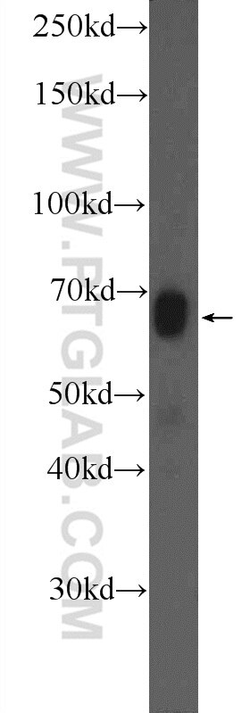 Western Blot (WB) analysis of mouse kidney tissue using Osteopontin Polyclonal antibody (25715-1-AP)