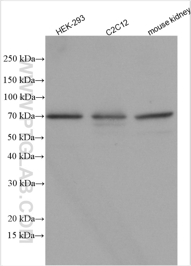 Western Blot (WB) analysis of various lysates using Osteopontin Polyclonal antibody (25715-1-AP)
