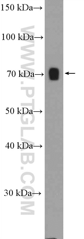Western Blot (WB) analysis of rat kidney tissue using Osteopontin Polyclonal antibody (25715-1-AP)