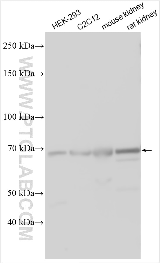 Western Blot (WB) analysis of various lysates using Osteopontin Polyclonal antibody (25715-1-AP)