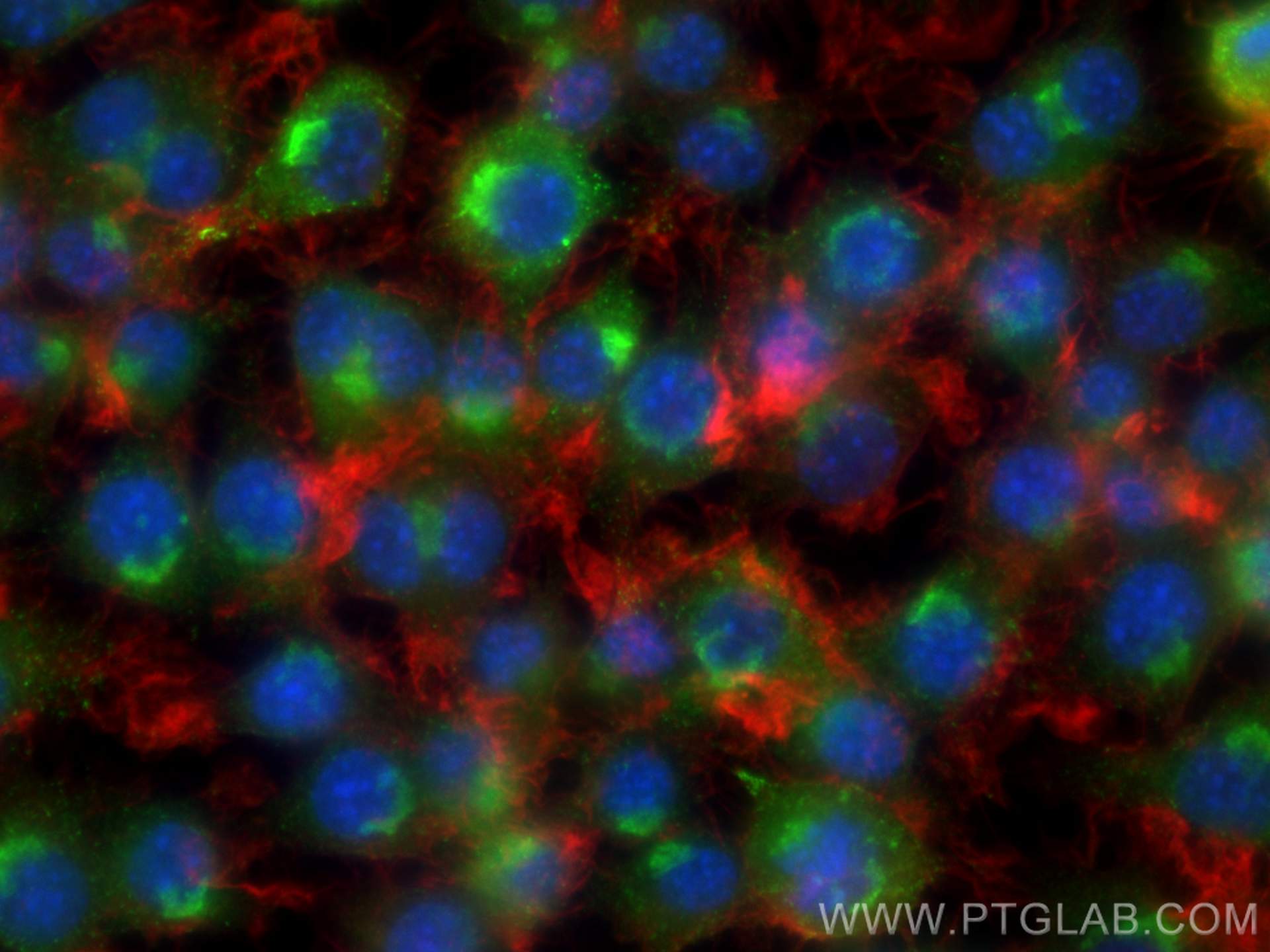 Immunofluorescence (IF) / fluorescent staining of RAW 264.7 cells using Osteopontin Polyclonal antibody (30200-1-AP)