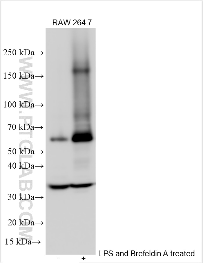 Western Blot (WB) analysis of various lysates using Osteopontin Polyclonal antibody (30200-1-AP)
