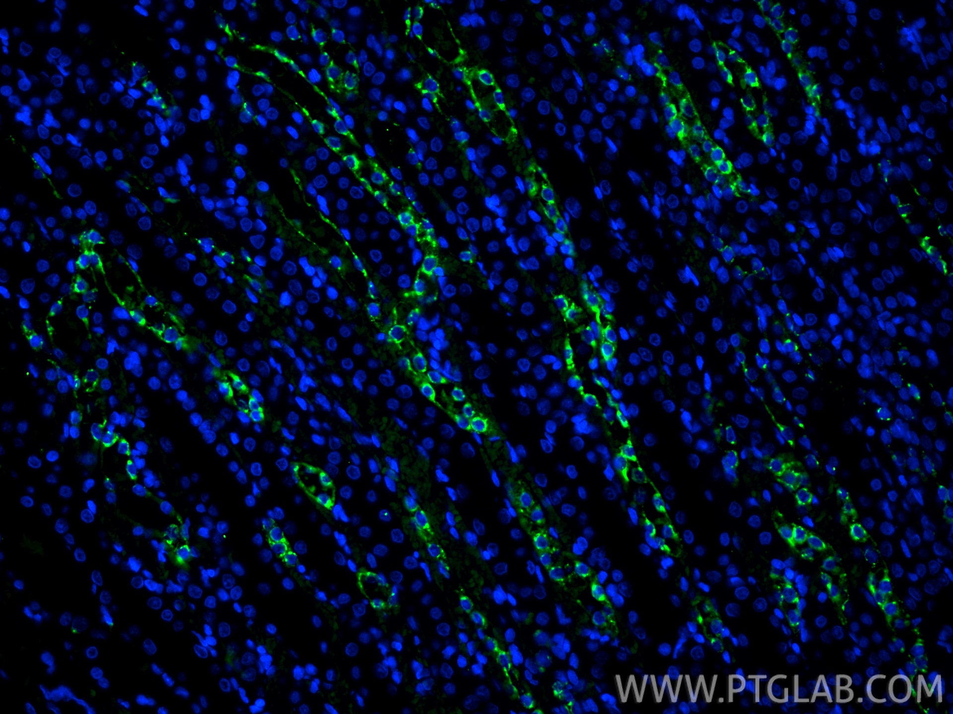 Immunofluorescence (IF) / fluorescent staining of rat kidney tissue using CoraLite® Plus 488-conjugated Osteopontin Polyclon (CL488-22952)