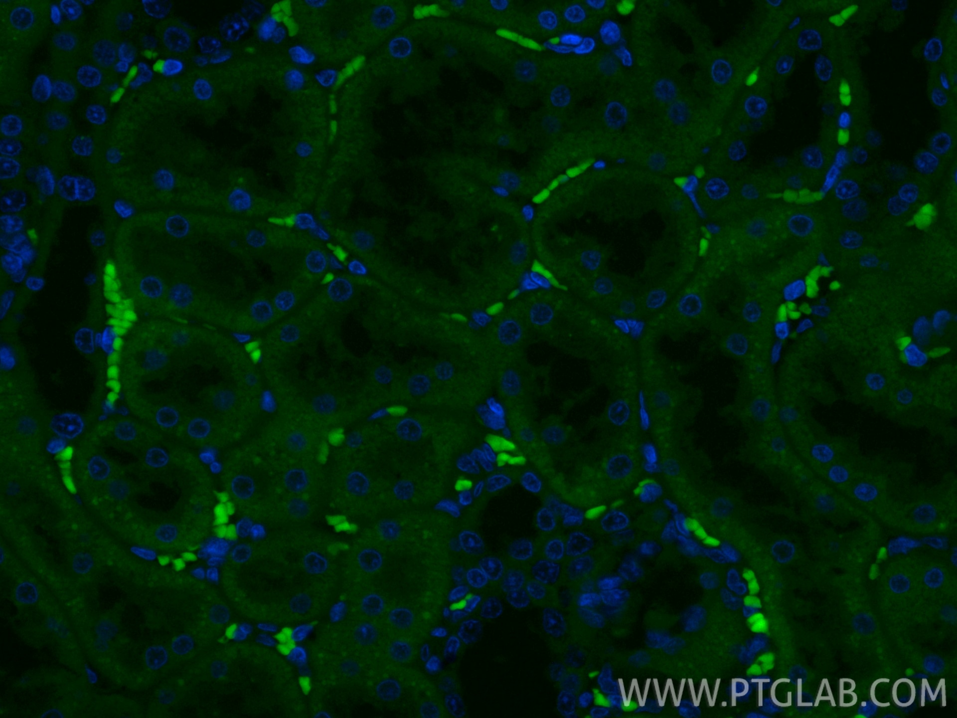 Immunofluorescence (IF) / fluorescent staining of rat kidney tissue using CoraLite® Plus 488-conjugated Osteopontin Polyclon (CL488-22952)