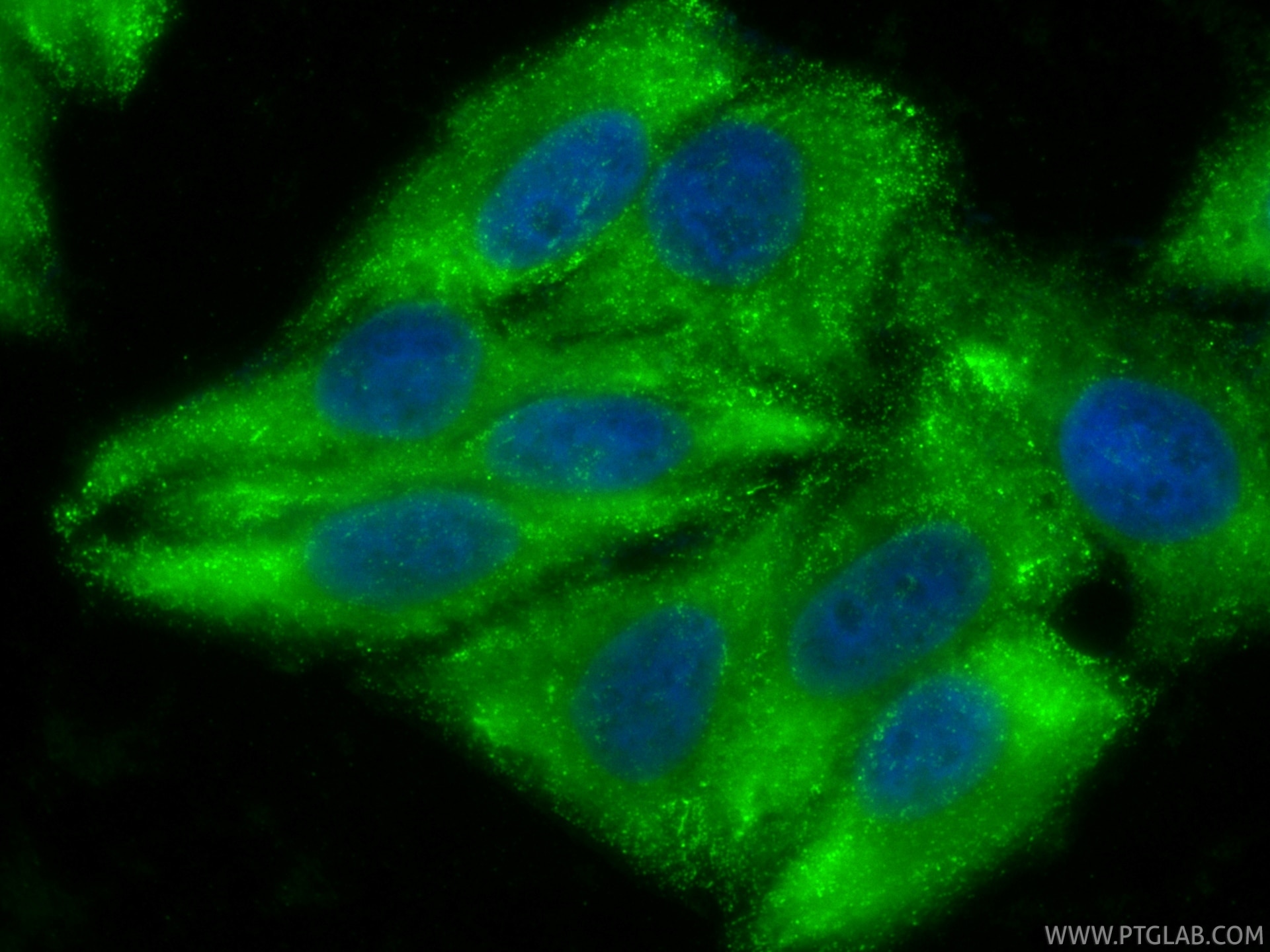 Immunofluorescence (IF) / fluorescent staining of HepG2 cells using CoraLite® Plus 488-conjugated Osteopontin Recombin (CL488-83341)