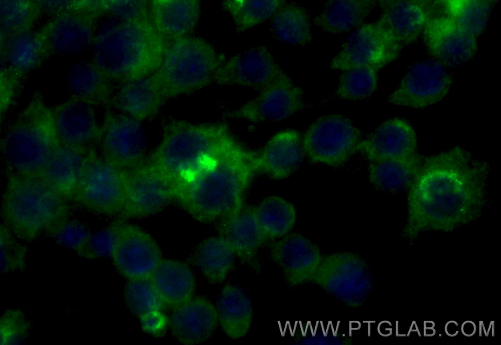Immunofluorescence (IF) / fluorescent staining of RAW 264.7 cells using CoraLite® Plus 488-conjugated Osteopontin Recombin (CL488-83413-6)