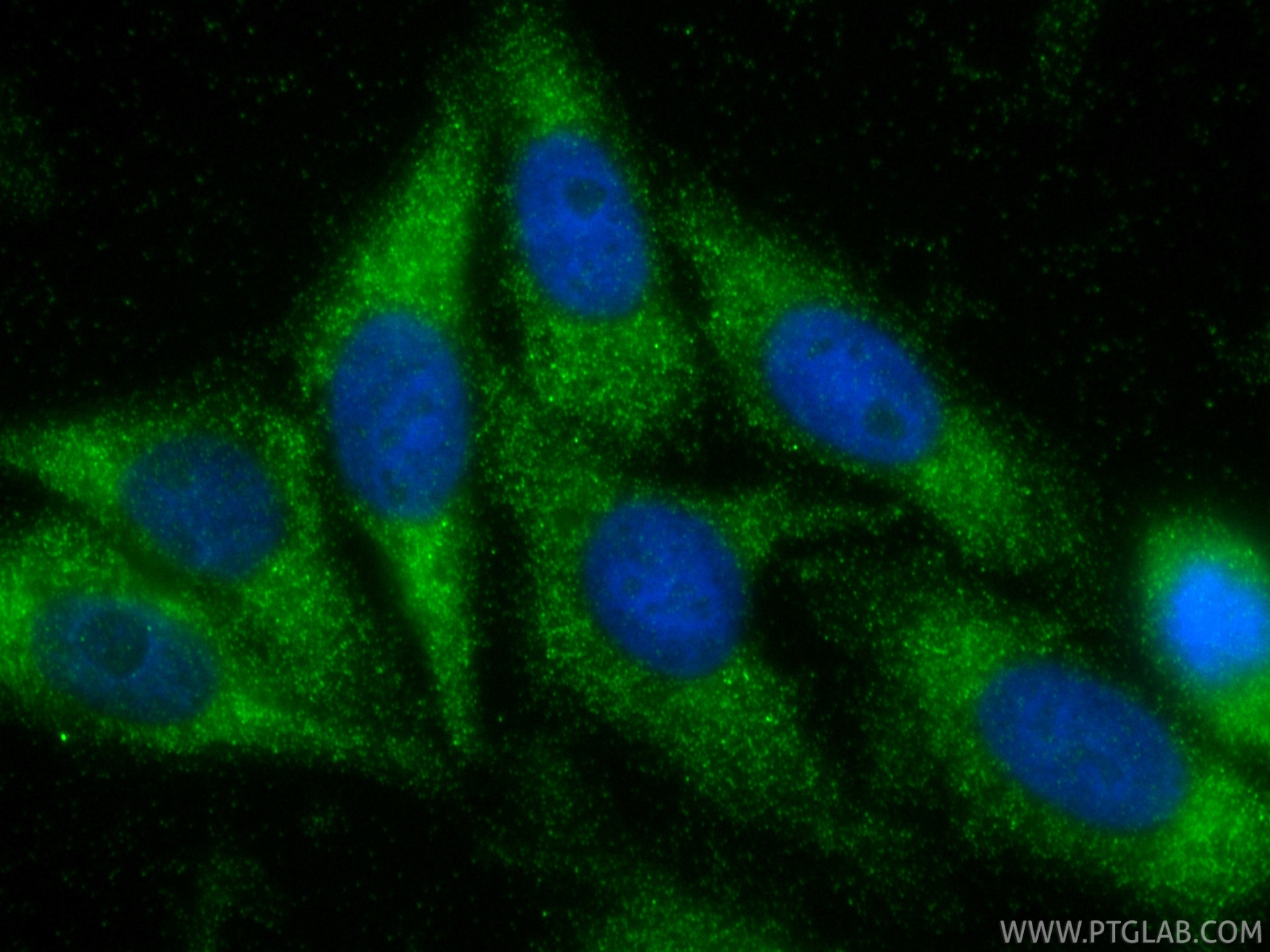 IF Staining of HepG2 using 31766-1-AP Immunofluorescence (IF) / fluorescent staining of HepG2 cells using Osteoprotegerin/TNFRSF11B Polyclonal antibody (31766-1-AP)