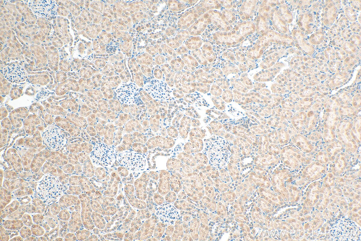 Immunohistochemistry (IHC) staining of rat kidney tissue using Osteoprotegerin/TNFRSF11B Polyclonal antibody (31766-1-AP)