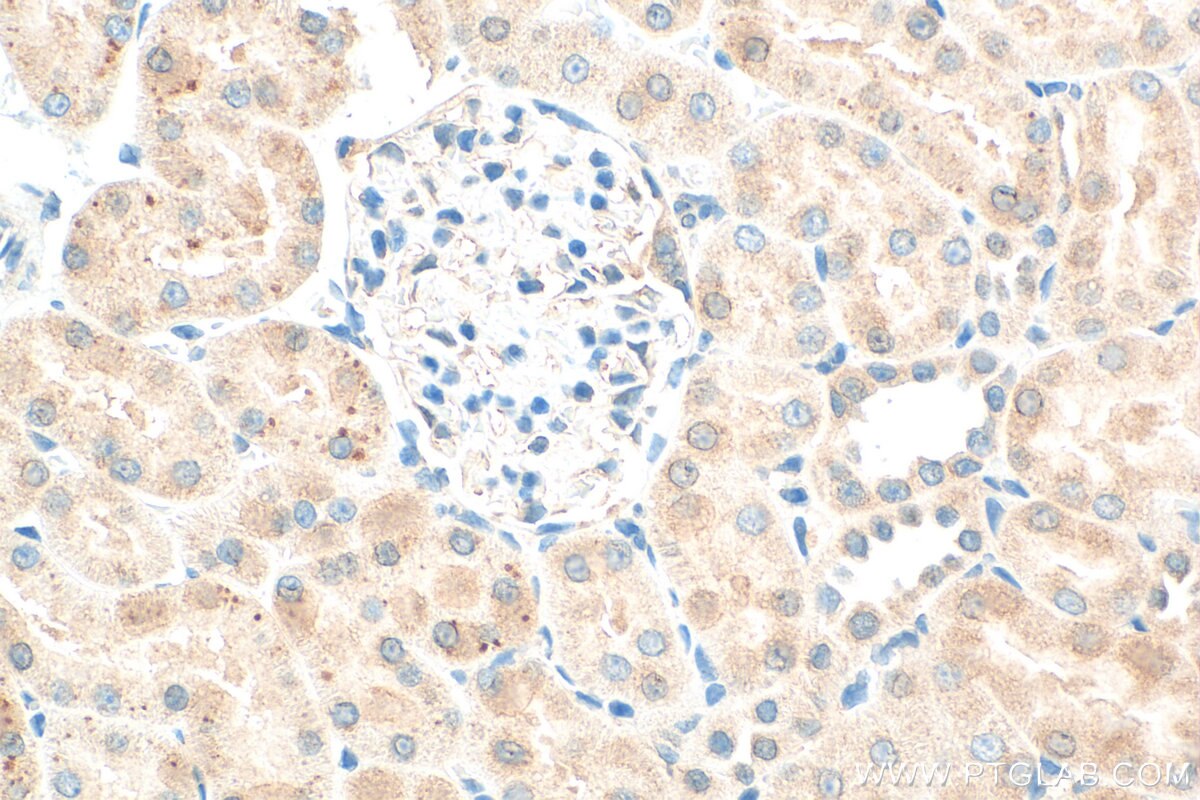 Immunohistochemistry (IHC) staining of rat kidney tissue using Osteoprotegerin/TNFRSF11B Polyclonal antibody (31766-1-AP)