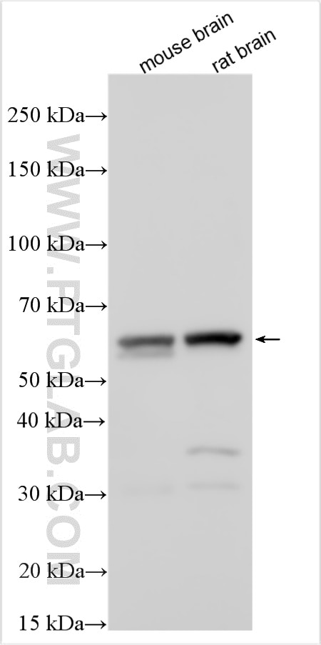 Western Blot (WB) analysis of various lysates using Osteoprotegerin/TNFRSF11B Polyclonal antibody (31766-1-AP)