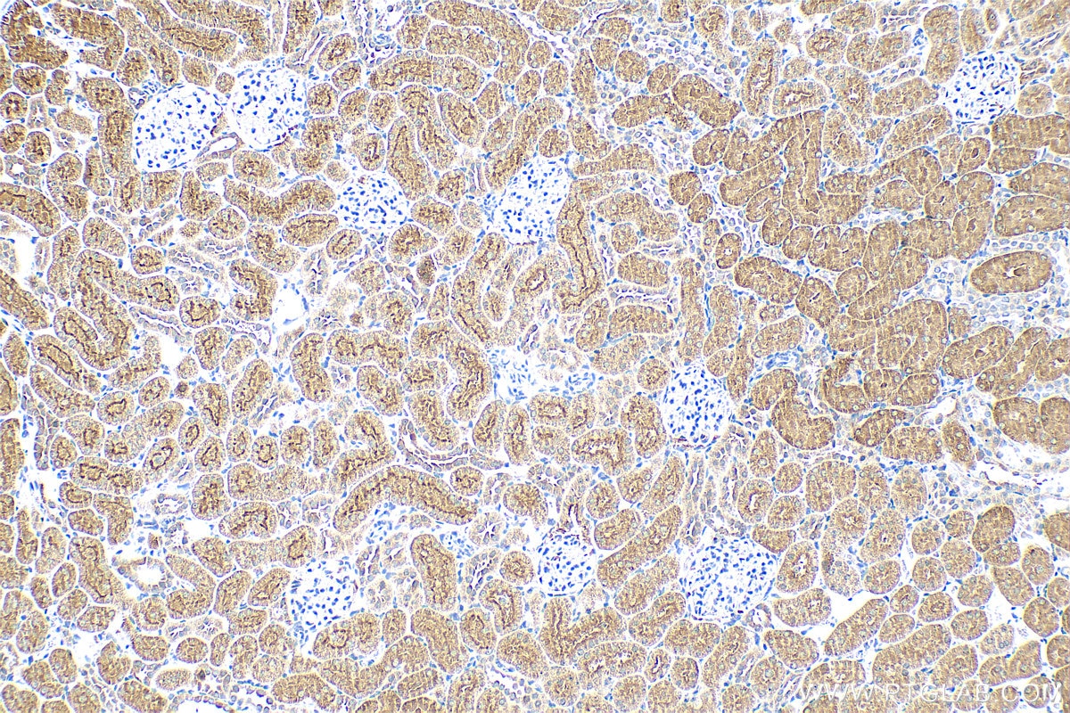 Osteoprotegerin/TNFRSF11B