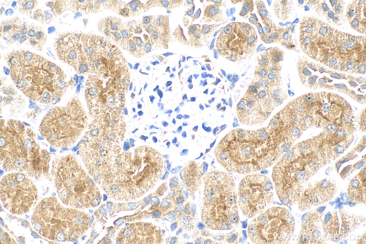 Immunohistochemistry (IHC) staining of rat kidney tissue using Osteoprotegerin/TNFRSF11B Recombinant antibody (83506-1-RR)