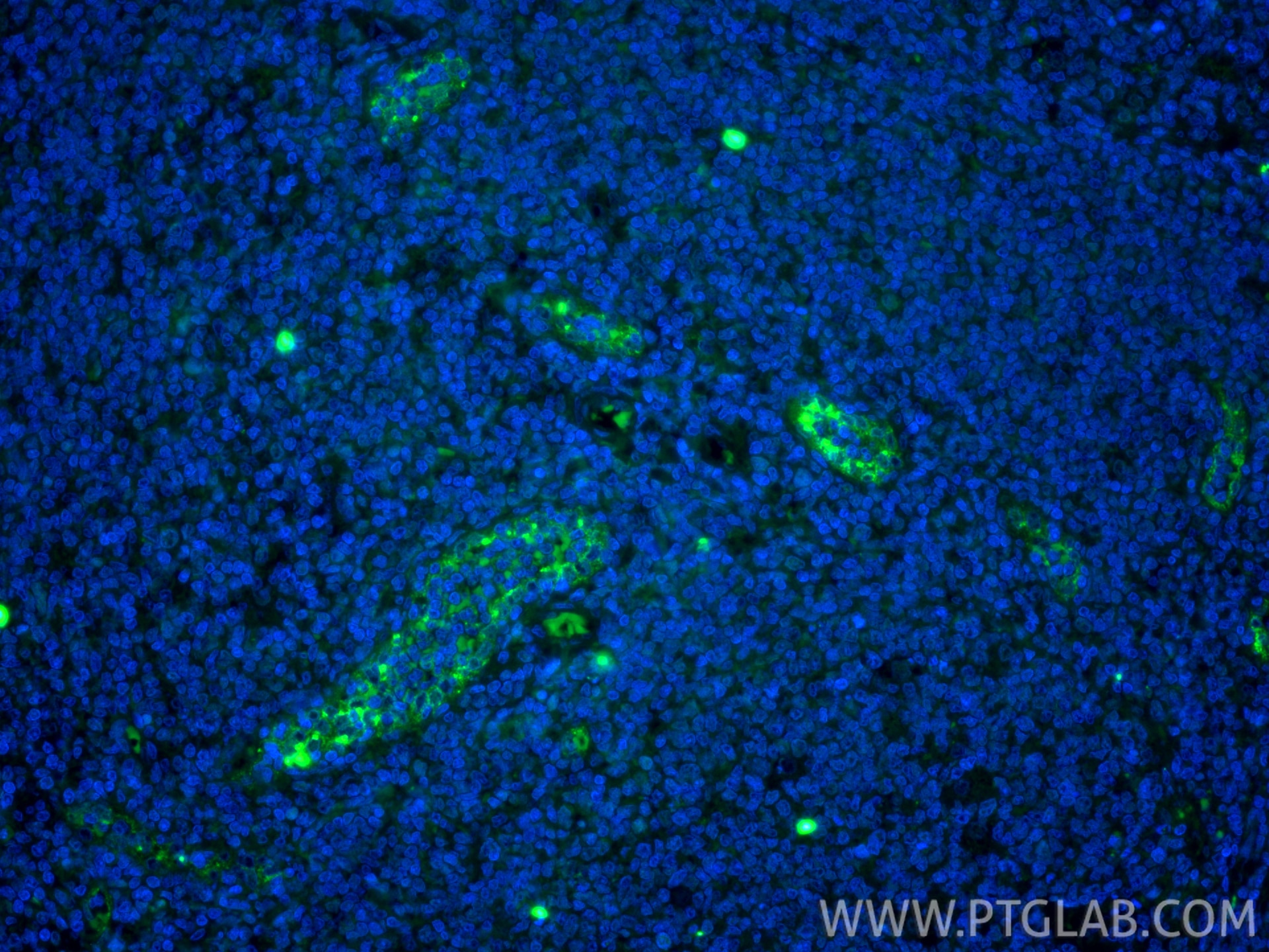 Immunofluorescence (IF) / fluorescent staining of human tonsillitis tissue using CoraLite® Plus 488-conjugated P-Selectin/CD62P Rec (CL488-83947-5)