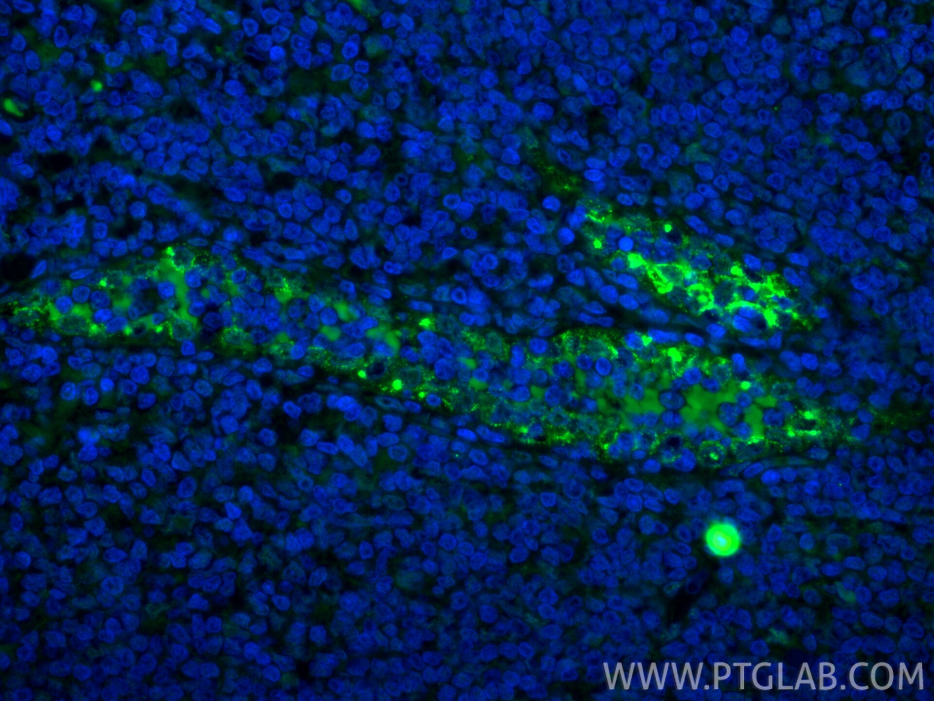 Immunofluorescence (IF) / fluorescent staining of human tonsillitis tissue using CoraLite® Plus 488-conjugated P-Selectin/CD62P Rec (CL488-83947-5)
