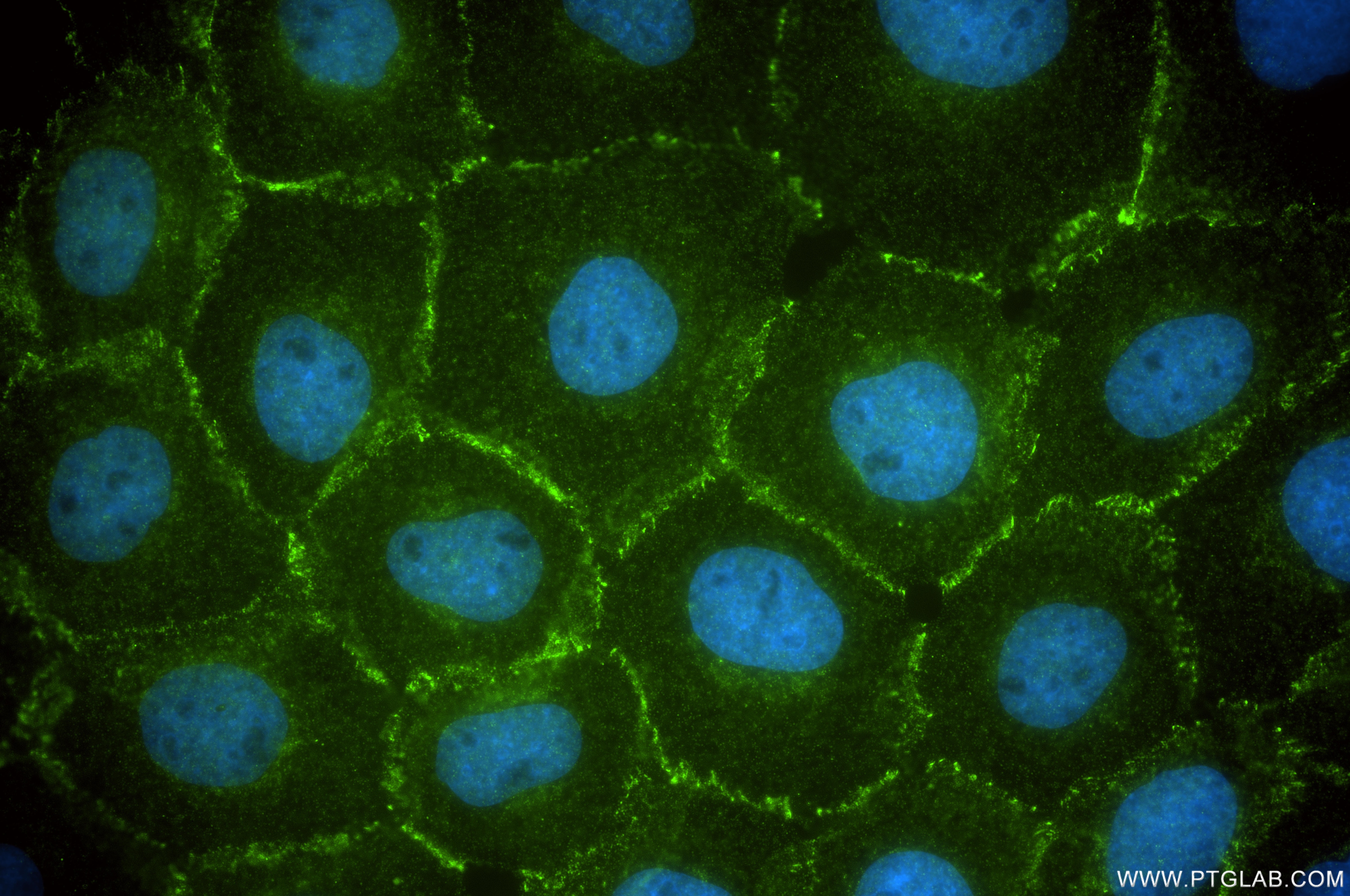 Immunofluorescence (IF) / fluorescent staining of A431 cells using P-cadherin Recombinant monoclonal antibody (86776-1-RR)