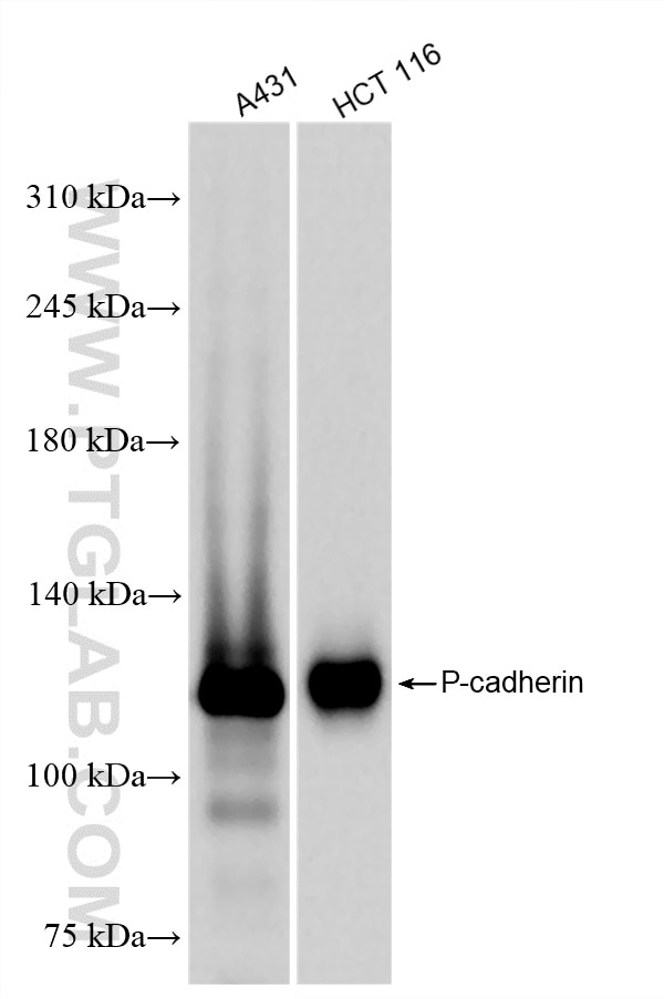 Western Blot (WB) analysis of various lysates using P-cadherin Recombinant monoclonal antibody (86776-1-RR)