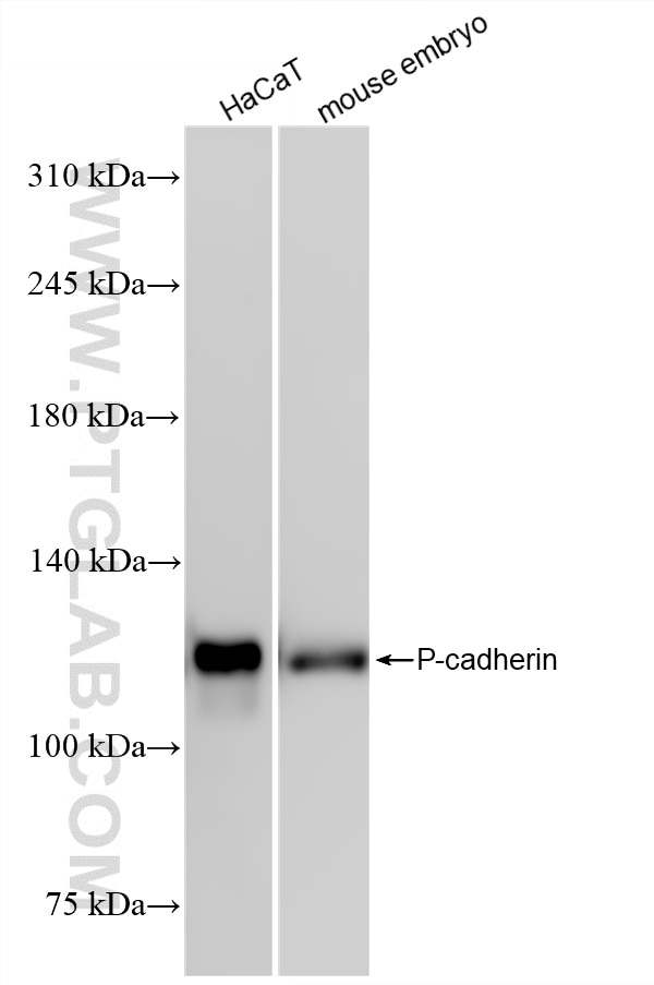 Western Blot (WB) analysis of various lysates using P-cadherin Recombinant monoclonal antibody (86776-1-RR)