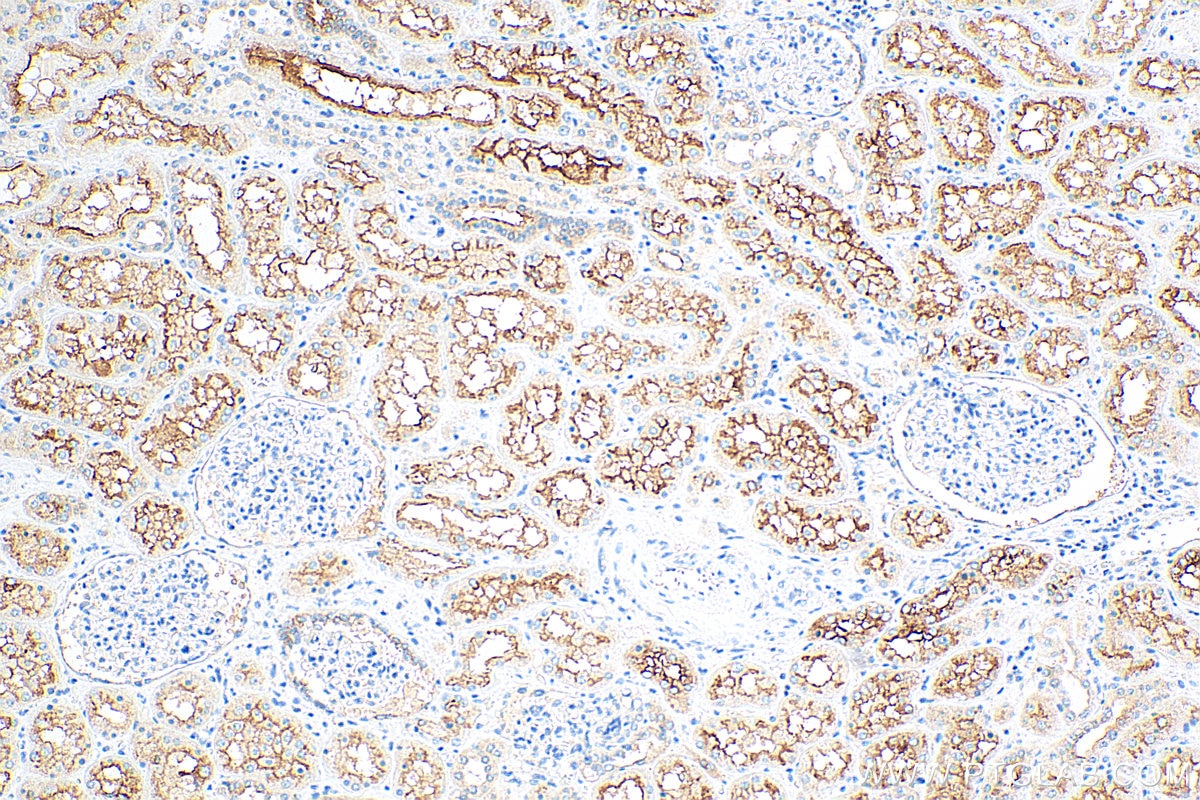 Immunohistochemistry (IHC) staining of human kidney tissue using P glycoprotein Monoclonal antibody (67258-2-Ig)