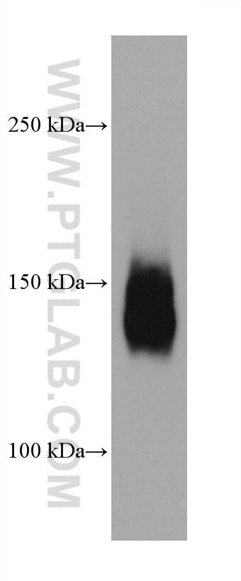 Western Blot (WB) analysis of HepG2 cells using P glycoprotein Monoclonal antibody (67258-2-Ig)