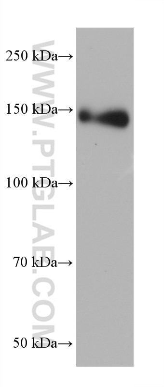 Western Blot (WB) analysis of HeLa cells using P glycoprotein Monoclonal antibody (67258-2-Ig)