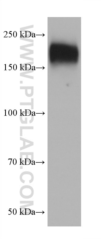Western Blot (WB) analysis of SH-SY5Y cells using P glycoprotein Monoclonal antibody (67258-2-Ig)
