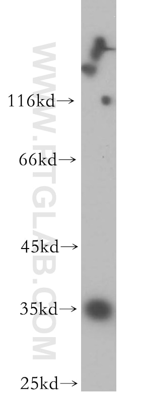 Western Blot (WB) analysis of HeLa cells using PP11 Polyclonal antibody (18002-1-AP)