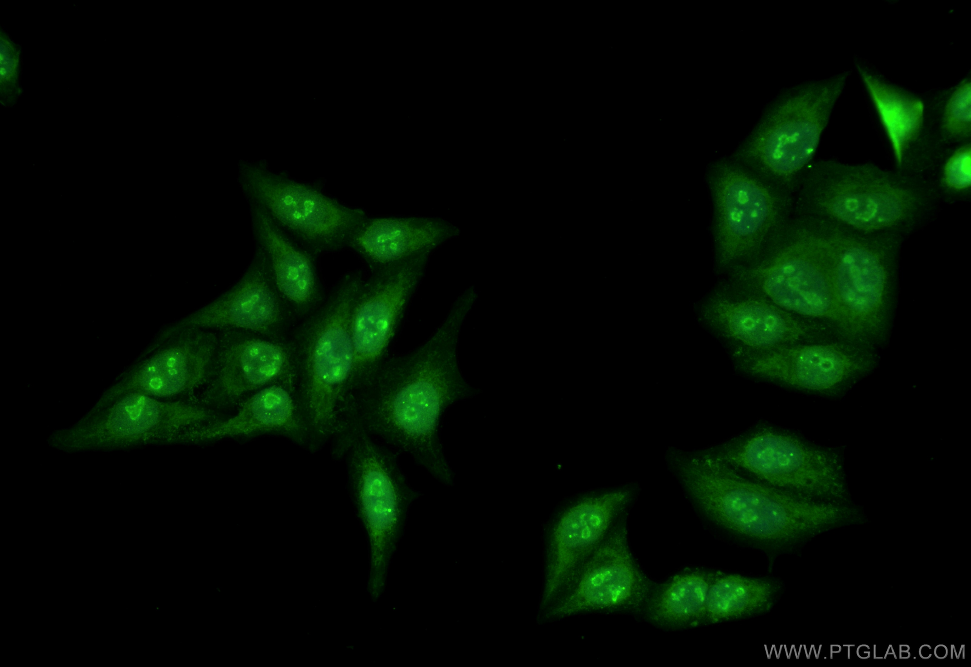 Immunofluorescence (IF) / fluorescent staining of HepG2 cells using NOLC1 Polyclonal antibody (11815-1-AP)