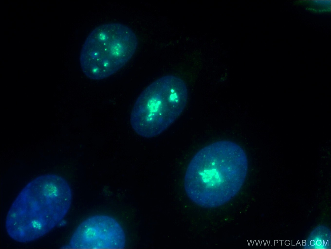 IF Staining of HepG2 using 11815-1-AP