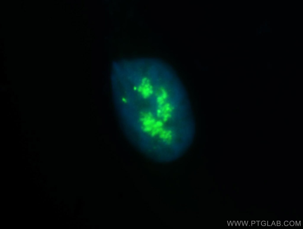 Immunofluorescence (IF) / fluorescent staining of HepG2 cells using NOLC1 Polyclonal antibody (11815-1-AP)