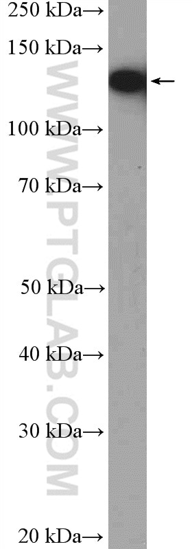 Western Blot (WB) analysis of Jurkat cells using NOLC1 Polyclonal antibody (11815-1-AP)