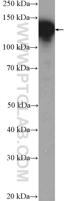 Western Blot (WB) analysis of Jurkat cells using NOLC1 Polyclonal antibody (11815-1-AP)