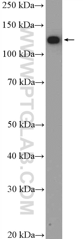 Western Blot (WB) analysis of Jurkat cells using NOLC1 Polyclonal antibody (11815-1-AP)