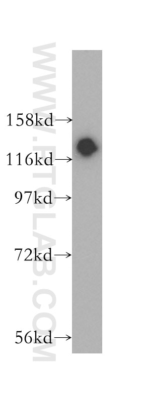 NOLC1 Polyclonal antibody